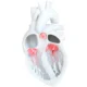 trileaflet aortic valve